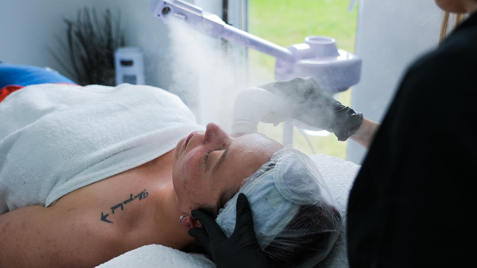Microneedling Privates Spa